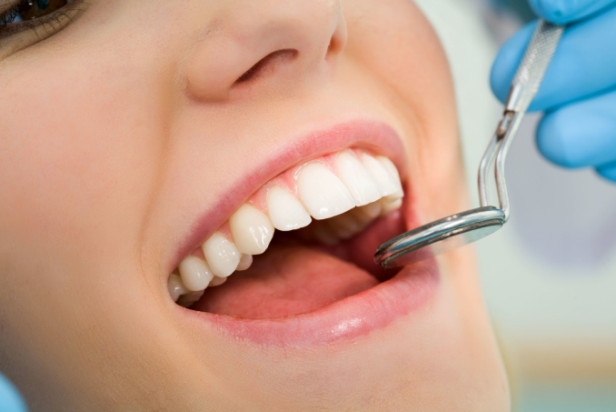 Woman Having Dental Implants Checked