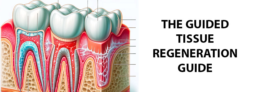 The Guided Tissue Regeneration Guide