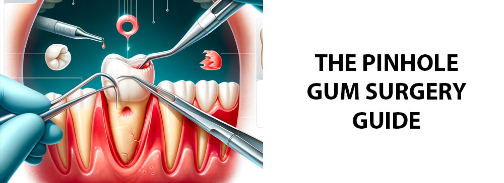 The Pinhole Gum Surgery Guide: Advantages and Disadvantages