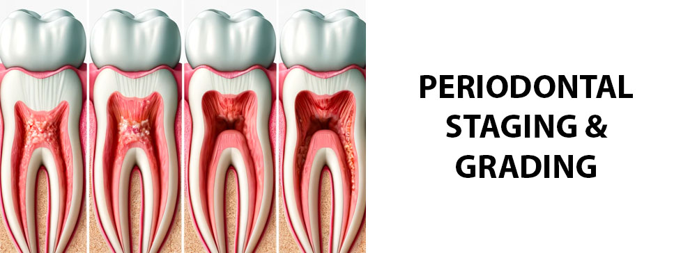 The Periodontal Staging and Grading Guide: Periodontitis Classification
