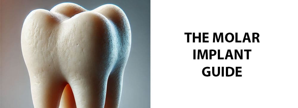 The Guide To Molar Implants: Average Cost & Replacement