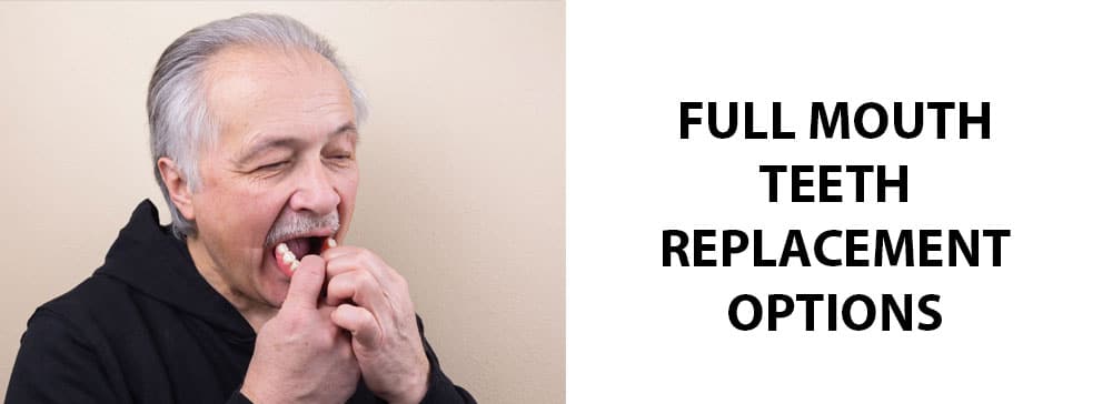 Full Mouth Teeth Replacement Options