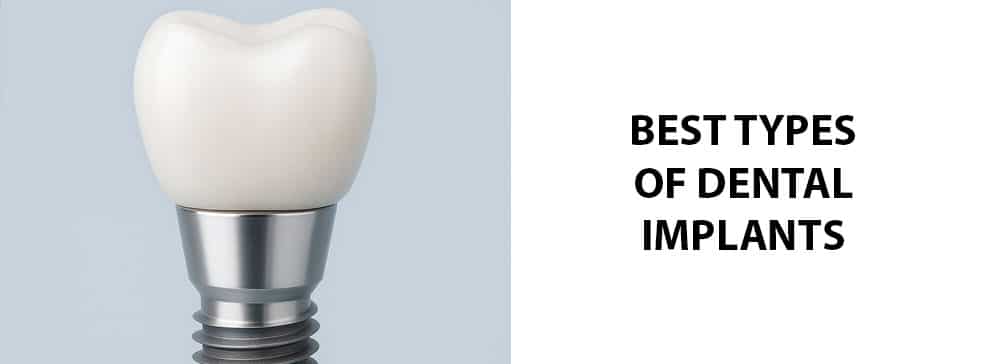 Best Types of Dental Implants