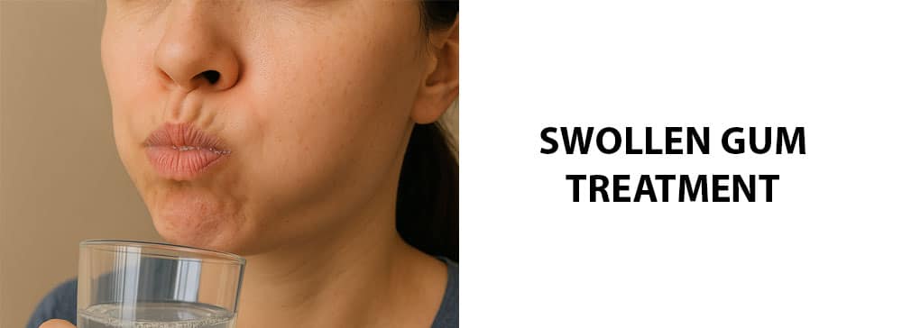 The Swollen Gum Treatment Guide: What’s The Fastest Way To Heal Them?