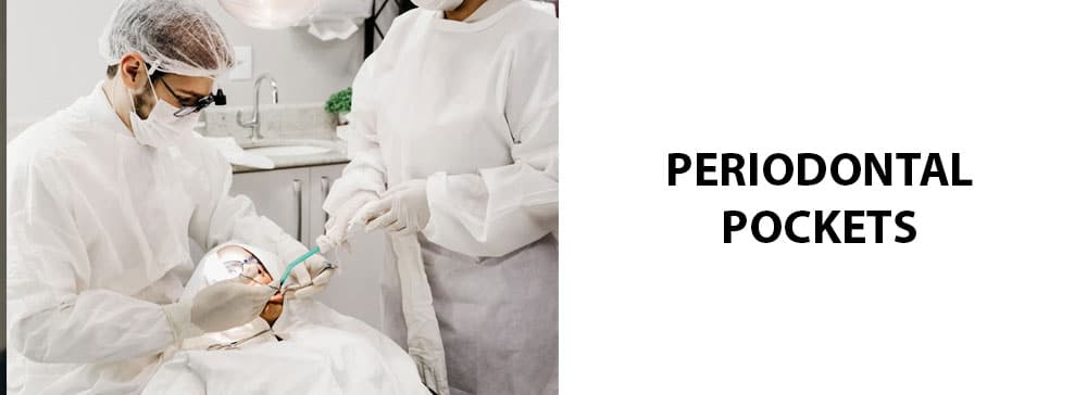 Periodontal Pockets