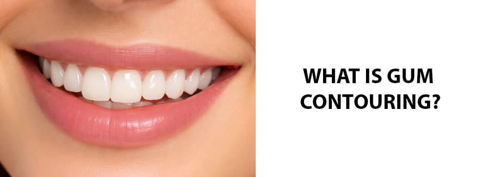 What Is Gum Contouring?