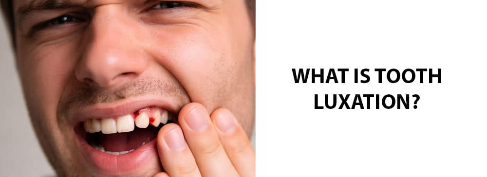 What Is Tooth Luxation?