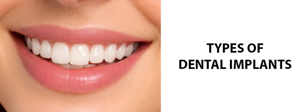 Types of Dental Implants